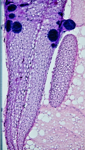 The Image Displays A Close-up View Of A Purple Tissue, Possibly A Piece Of Brain Tissue