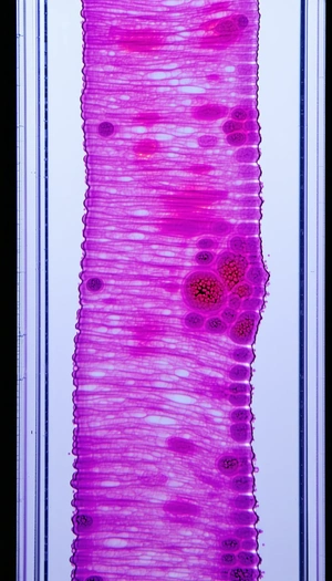 A Microscope Slide With A Purple Tissue Sample
