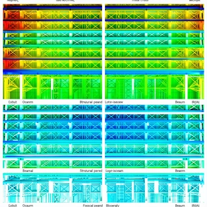 The Image Is A Graphic Representation Of A Bridge, Showing Its Structural Components