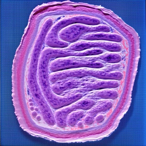 A Close-up Of A Purple Tissue, Possibly A Piece Of A Brain Or A Heart