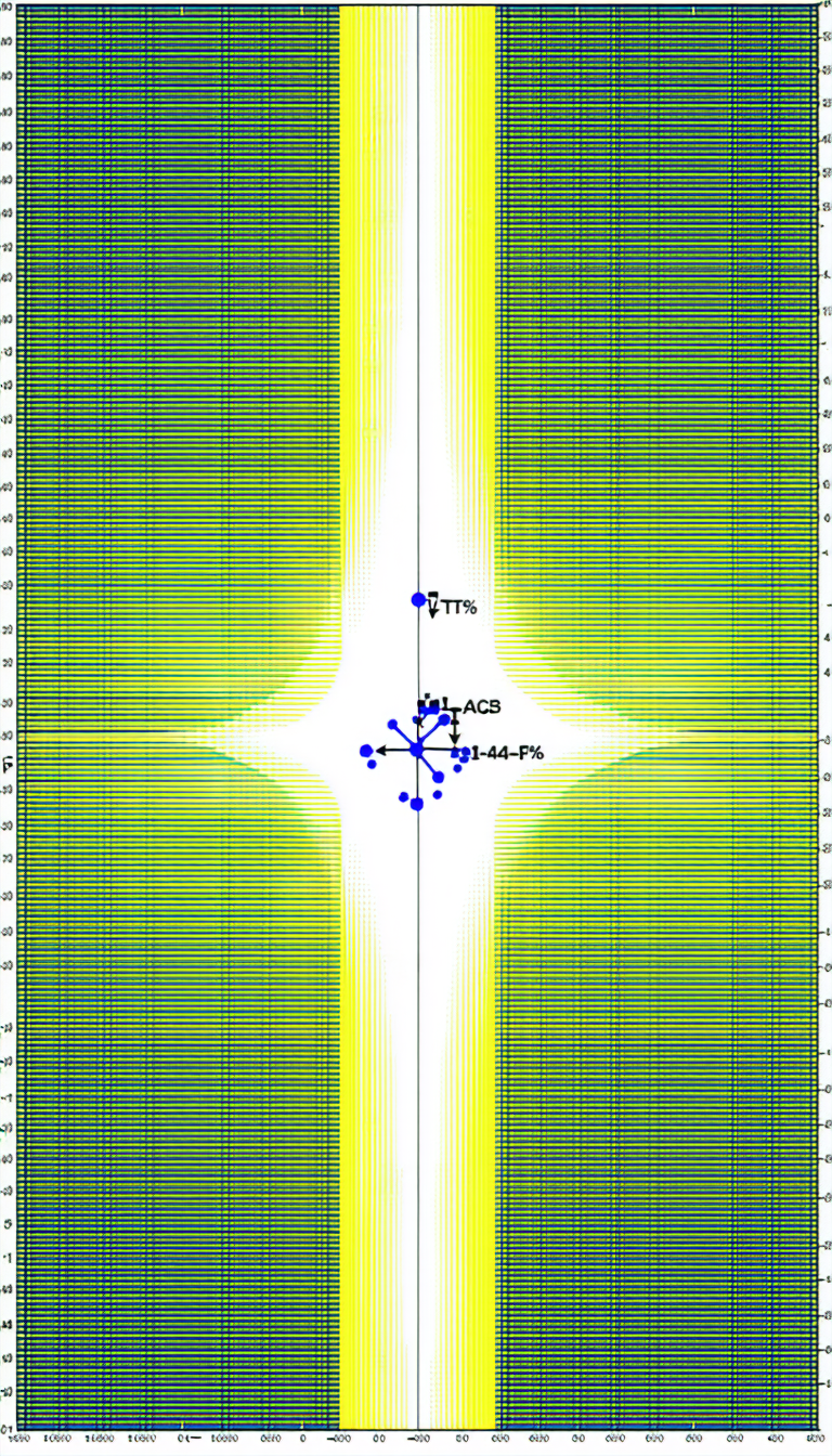 The Image Displays A Computer-generated Graphic Of A Yellow And Green Tunnel